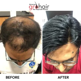 Hair Transformation 11