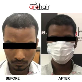 Hair Transformation 4