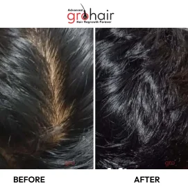 Hair Transformation 6